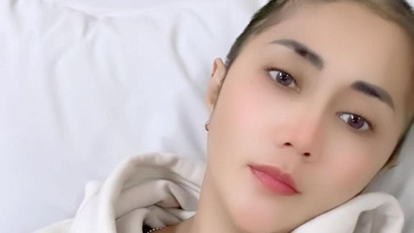 Potret Aida Saskia yang Berjuang Melawan Kanker Payudara