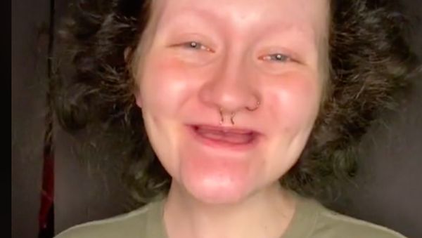 8 Foto Influencer yang Tak Punya Gigi & Alis, Menakjubkan Setelah Makeup