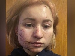 Warga Ukraina Korban Serangan Rusia Dituduh Buat Hoaks