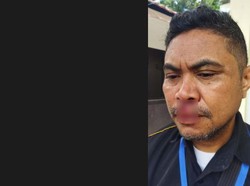 Wartawan di NTT Dianiaya Orang Misterius, AJI Kupang: Usut Tuntas!