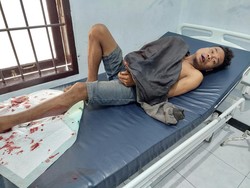 Polisi Tembak Buron Pemerkosa Gadis Disabilitas di Kupang