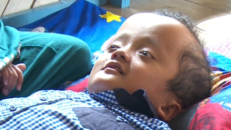 Mari Bantu Denda, Penderita Hidrosefalus yang Semangat Belajar Alquran