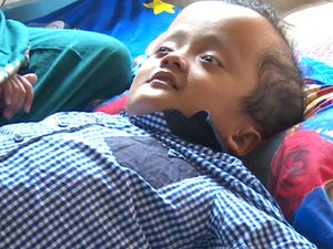 Mari Bantu Denda, Penderita Hidrosefalus yang Semangat Belajar Alquran