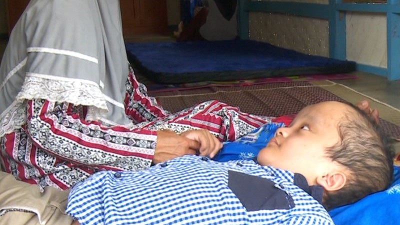 Penderita Hidrosefalus Anak Penjual Tempe Butuh Fisioterapi, Kamu Bisa Bantu