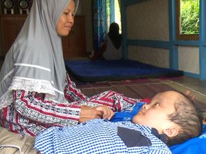 Penderita Hidrosefalus Anak Penjual Tempe Butuh Fisioterapi, Kamu Bisa Bantu