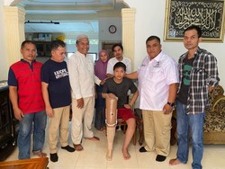 Andre Rosiade Hadiahkan Kaki Palsu untuk Eks Bintang PSP Padang U-13