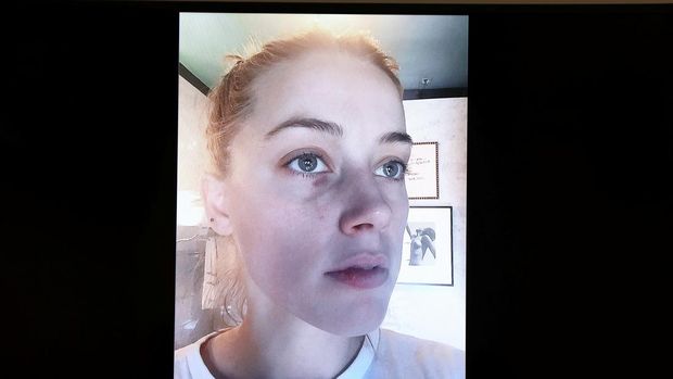 Bukti Kekerasan Johnny Depp Terhadap Amber Heard Evidence appears on a monitor during Johnny Depp's defamation case against ex-wife, actor Amber Heard in Fairfax, Virginia, U.S., May 5, 2022. Jim Lo Scalzo/Pool via REUTERS