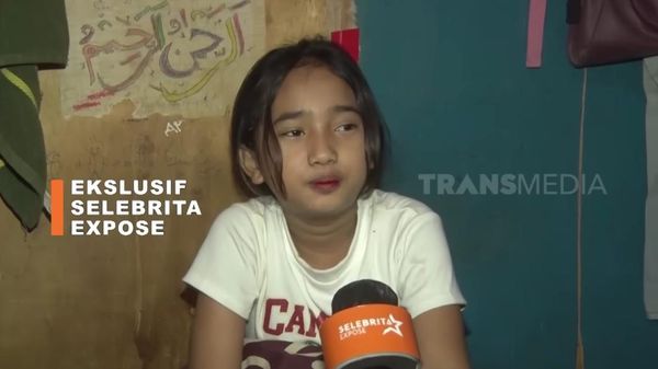 7 Foto Elin, Pengamen Badut Cilik yang Kecantikannya Viral