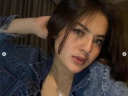 Iqlima Kim Sedot Lemak di Tangan dan Pipi demi Mempercantik Diri