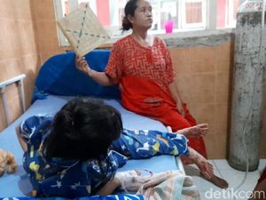 Tolong! Bocah Perempuan di Brebes Ini Sakit Kanker Mata Tolong! Bocah Perempuan di Brebes Ini Sakit Kanker Mata
