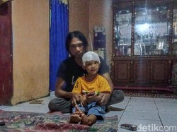 Biaya Bocah yang Terserempet Kereta Sudah Ditanggung BPJS