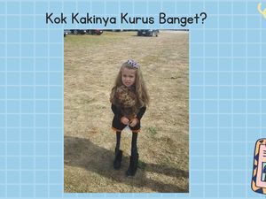 Deretan Ilusi Optik Ini Sempat Viral, Bisa Kamu Pecahkan Misterinya?