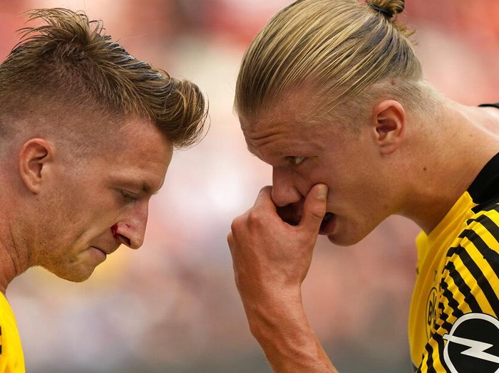 Dortmund's captain Marco Reus reacts disappointed during the German Bundesliga soccer match between Borussia Dortmund and Bayer Leverkusen in Dortmund, Germany, Sunday, Feb. 6, 2022. (AP Photo/Martin Meissner)
