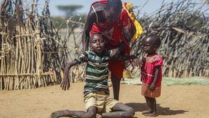 Wajah Memelas Akibat Kekeringan dan Kelaparan di Tanduk Afrika