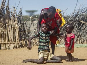 Wajah Memelas Akibat Kekeringan dan Kelaparan di Tanduk Afrika