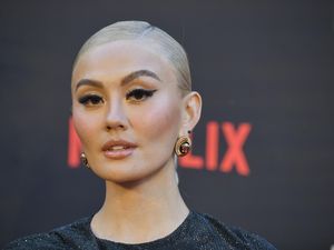 Reaksi Agnez Mo Dikretek Ahli Chiropractic California