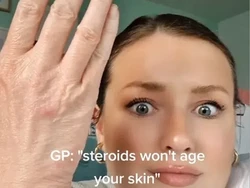 Wanita 28 Tahun Ini Tangannya Keriput Seperti 98 Tahun, Ini Penyebabnya