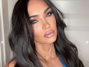 Ramai Megan Fox Disebut Xenophobia, Riwayat Kesehatan Mentalnya Disorot Lagi