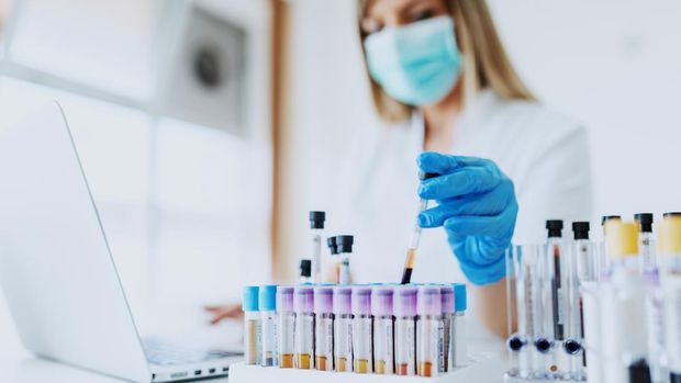 Blood Test, Blood, Medical Sample, Test Tube