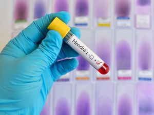 Duh! Virus Hendra Muncul Lagi di Negara Tetangga RI Duh! Virus Hendra Muncul Lagi di Negara Tetangga RI