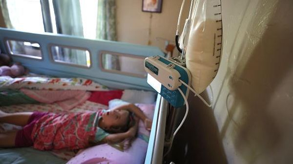 Kisah Anak Down Syndrome di AS yang Terdampak Kelangkaan Susu Formula