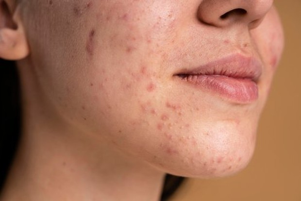 Kulit kering dan gatal/ Foto: freepik