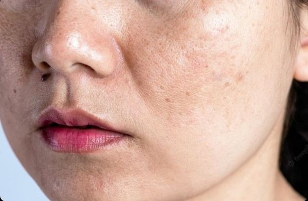 Tanda-tanda Penuaan Pada Kulit Wajah/Unsplash/Spukkato