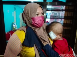 Alhamdulillah! Balita Asal Madura 9 Bulan Idap Tumor Mata Segera Dioperasi