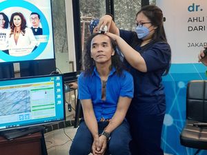 Berambut Gondrong, Kaka Slank Melakukan Transplantasi Rambut Berambut Gondrong, Kaka Slank Melakukan Transplantasi Rambut