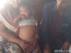 Balita Penderita Kanker Ginjal di Sampang Butuh Uluran Tangan Dermawan