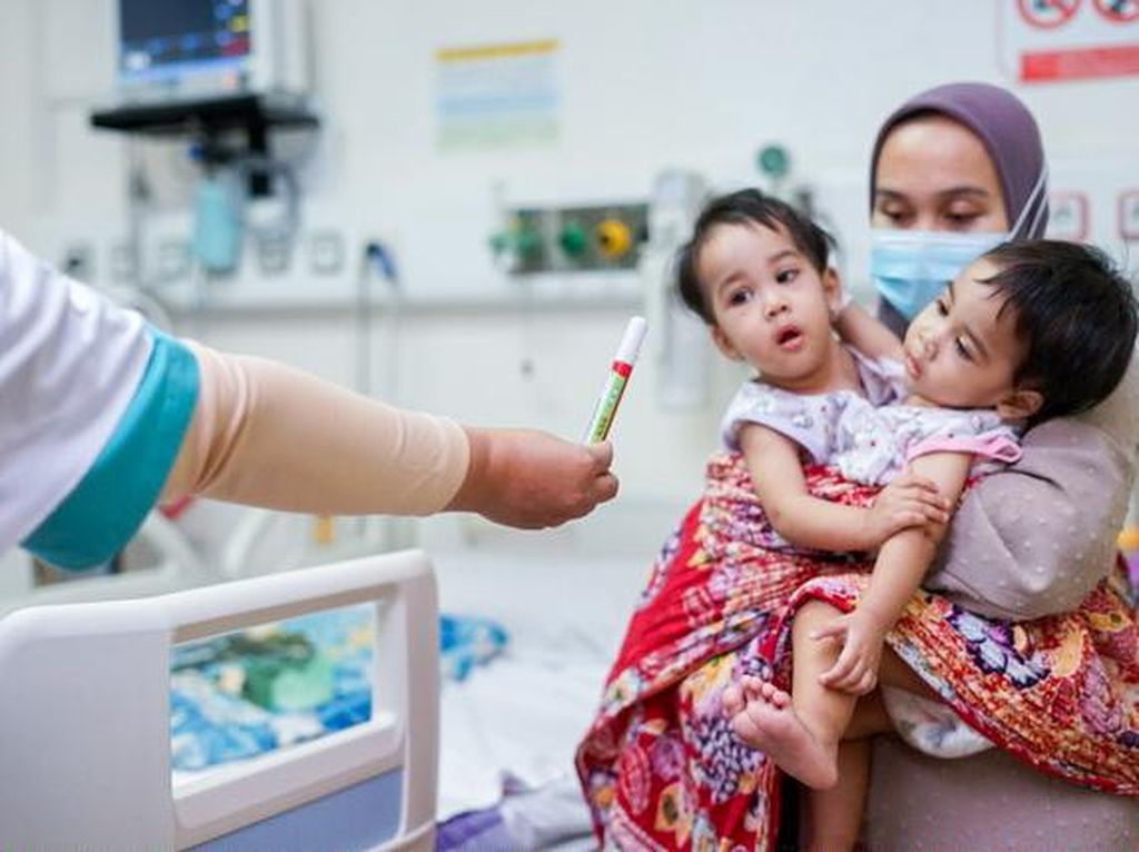 Bayi Kembar Siam Sukabumi Berhasil Dipisahkan di RSHS Bayi Kembar Siam Sukabumi Berhasil Dipisahkan di RSHS