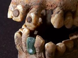 Apa Itu Gigi Emas? Suku Maya Tanam Gigi Permata!