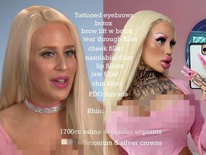 Penampilan Wanita yang Obsesi Oplas, Dulu Normal Kini Mirip Boneka Seks Penampilan Wanita yang Obsesi Oplas, Dulu Normal Kini Mirip Boneka Seks