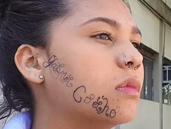 Kasihan, Kisah Remaja Diculik, Dipaksa Tato Nama Mantan Pacar di Wajahnya