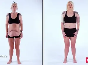 Curhatan Sedih Wanita Turun BB Sampai 107 Kg, Begini Kondisi Kulit Perutnya Curhatan Sedih Wanita Turun BB Sampai 107 Kg, Begini Kondisi Kulit Perutnya