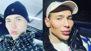 8 Foto Transformasi Mantan Tentara Rusia, Dulu Bak Popeye Kini Jadi Alien