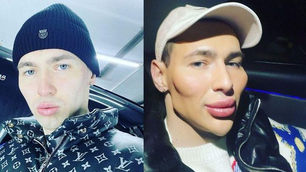 8 Foto Transformasi Mantan Tentara Rusia, Dulu Bak Popeye Kini Jadi Alien