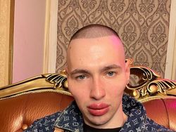 Transformasi Mantan Tentara Rusia yang Dulu Mirip Popeye Kini Jadi Alien