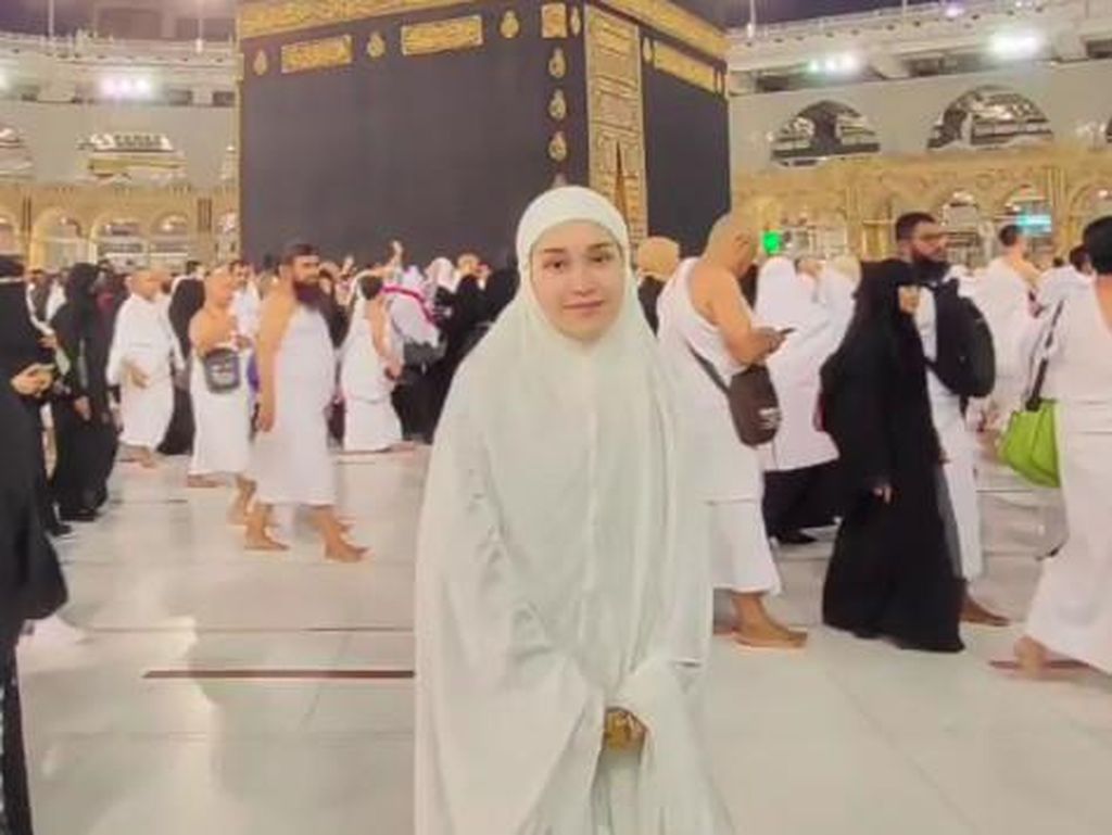 Kondisi Terkini Ayu Ting Ting Usai Muntah dan Badan Panas saat Tiba di Mekkah