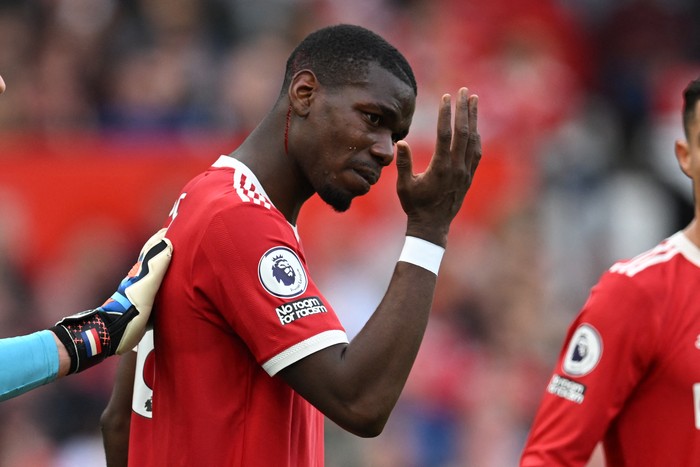 Blood flows from a headwound after Manchester Uniteds French midfielder Paul Pogba suffers an injury during the English Premier League football match between Manchester United and Norwich City at Old Trafford in Manchester, north west England, on April 16, 2022. - RESTRICTED TO EDITORIAL USE. No use with unauthorized audio, video, data, fixture lists, club/league logos or live services. Online in-match use limited to 120 images. An additional 40 images may be used in extra time. No video emulation. Social media in-match use limited to 120 images. An additional 40 images may be used in extra time. No use in betting publications, games or single club/league/player publications. (Photo by Paul ELLIS / AFP) / RESTRICTED TO EDITORIAL USE. No use with unauthorized audio, video, data, fixture lists, club/league logos or live services. Online in-match use limited to 120 images. An additional 40 images may be used in extra time. No video emulation. Social media in-match use limited to 120 images. An additional 40 images may be used in extra time. No use in betting publications, games or single club/league/player publications. / RESTRICTED TO EDITORIAL USE. No use with unauthorized audio, video, data, fixture lists, club/league logos or live services. Online in-match use limited to 120 images. An additional 40 images may be used in extra time. No video emulation. Social media in-match use limited to 120 images. An additional 40 images may be used in extra time. No use in betting publications, games or single club/league/player publications. (Photo by PAUL ELLIS/AFP via Getty Images)