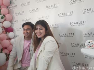Hamil Anak Kedua, Felicya Angelista Lebih Mual dan Bawel