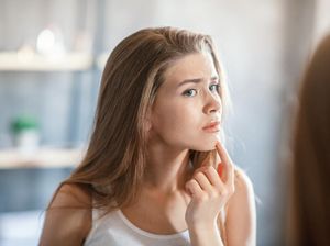 Cara Cepat Menghilangkan Jerawat di Dagu Menurut Dokter Kulit Cara Cepat Menghilangkan Jerawat di Dagu Menurut Dokter Kulit