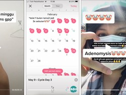 Viral Wanita Menstruasi Sebulan 3x, Ternyata Mengidap Penyakit Ini