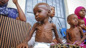 Foto Ini Tunjukkan Penderitaan Anak-anak Somalia yang Kena Gizi Buruk