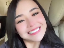 Pantes Glowing, Amanda Manopo Keluar Duit Rp 100 Juta Buat Perawatan