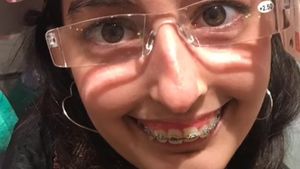 Transformasi Viral Wanita yang Di-bully, Balas Dendam dengan Operasi Plastik