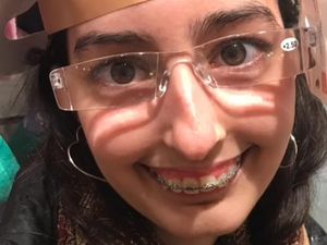 Transformasi Viral Wanita yang Di-bully, Balas Dendam dengan Operasi Plastik Transformasi Viral Wanita yang Di-bully, Balas Dendam dengan Operasi Plastik