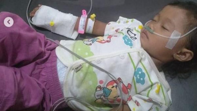 Mari Bantu Ayesha, Bocah Penderita Jantung Bocor di Jambi