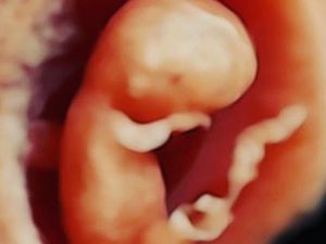 Temuan 7 Janin di Kotak Makan Geger di Makassar, Ini Fakta Terbarunya Temuan 7 Janin di Kotak Makan Geger di Makassar, Ini Fakta Terbarunya