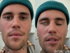 Justin Bieber Resmi Batalkan Konser Dunia usai Kena Ramsay Hunt Syndrome Justin Bieber Resmi Batalkan Konser Dunia usai Kena Ramsay Hunt Syndrome
